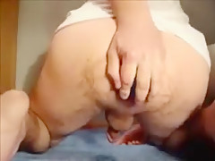 Asshole Extrem - fetish Anus
