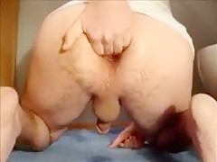 Asshole Extrem - fetish Anus