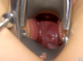 Edita's orgasms with a speculum in her fur pie
