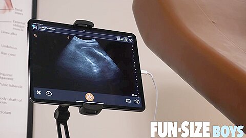 MAX Chapter 3 - Anal Ultrasound