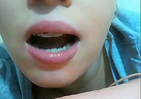 Mouth fetish braces