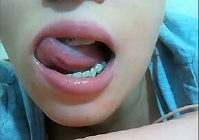 Mouth fetish braces