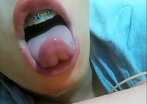 Mouth fetish braces