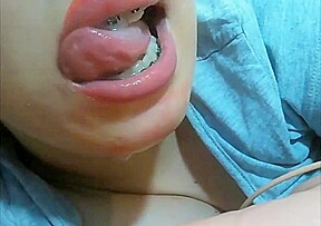 Mouth fetish braces