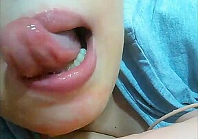Mouth fetish braces