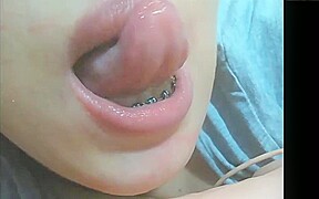 Mouth fetish braces