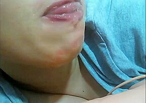 Mouth fetish braces