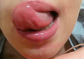 Mouth fetish braces