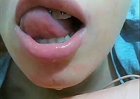 Mouth fetish braces