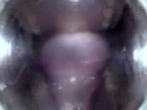 Mouthcam Angel2