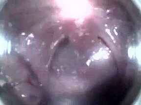 Mouthcam Angel2
