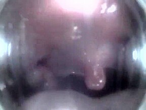Mouthcam Angel2