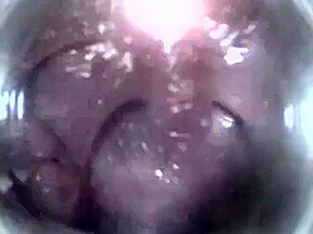 Mouthcam Angel2