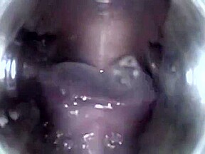 Mouthcam Angel2