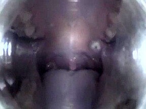 Mouthcam Angel2