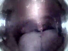 Mouthcam Angel2