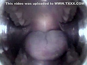 Mouthcam Angel2