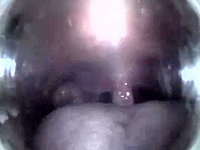 Mouthcam Angel2