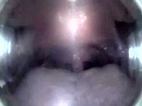 Mouthcam Angel2