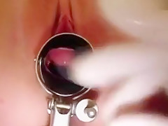 Rhoda visits pussy doctor for speculum examination